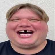 ybixx